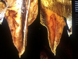 Tito Bustillo Galeria Antropomorfos